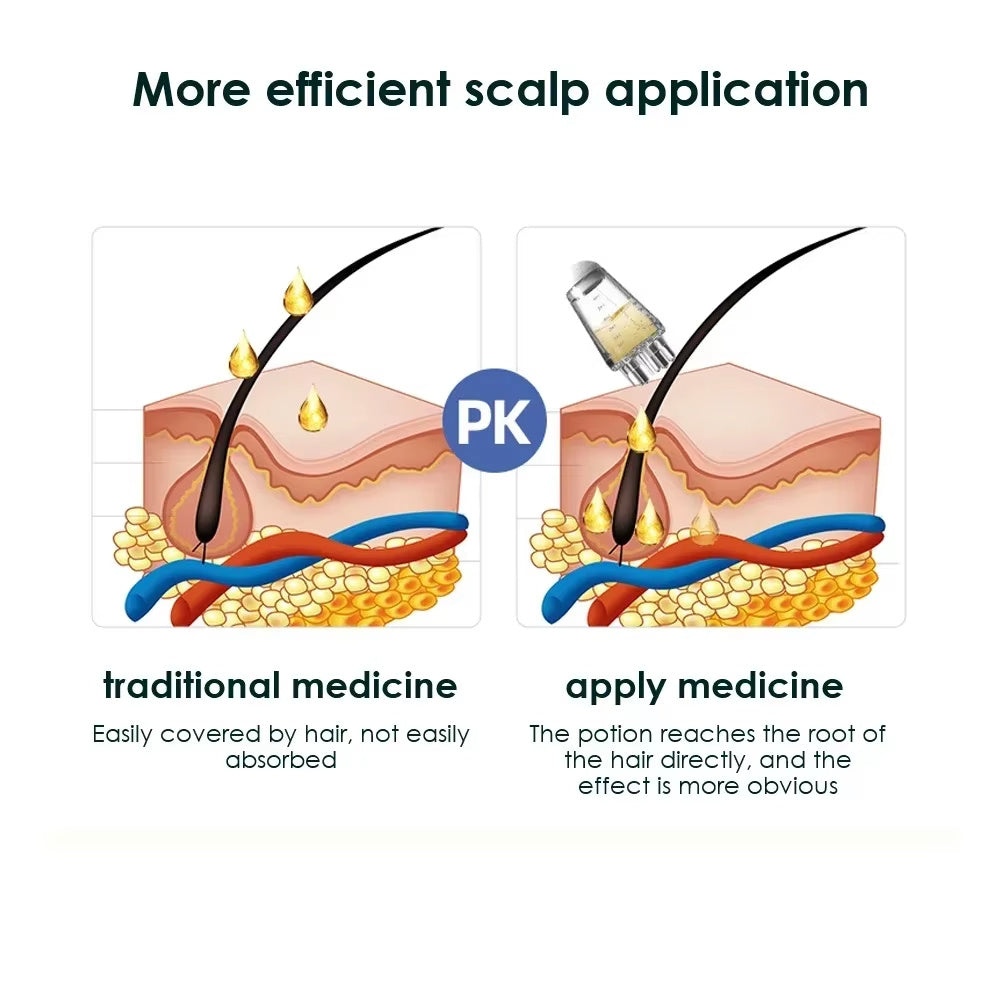 Scalp Oil Applicator